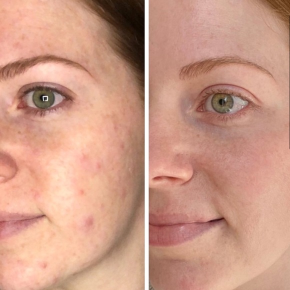 ✨Host Pick✨ Caudalie Vinopure Skin Perfecting Serum - Picture 2 of 4